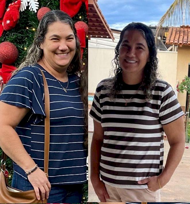 OBESIDADE: Médico calcula o fim das bariátricas em 10 anos