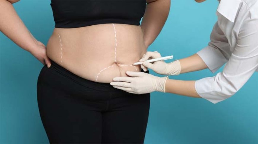 Cirurgia bariátrica vai além do emagrecimento e atua no controle de doenças ligadas à obesidade
